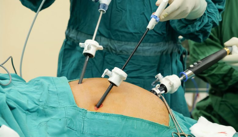 متخصص لاپاراسکوپی در شیراز