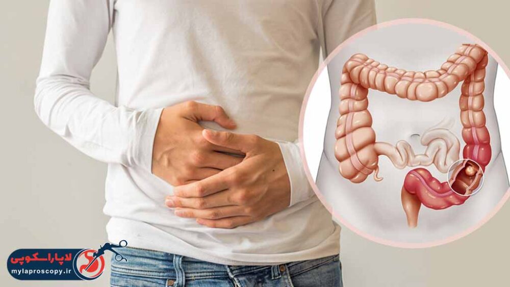 بهترین دکتر متخصص سرطان راست روده در شیراز