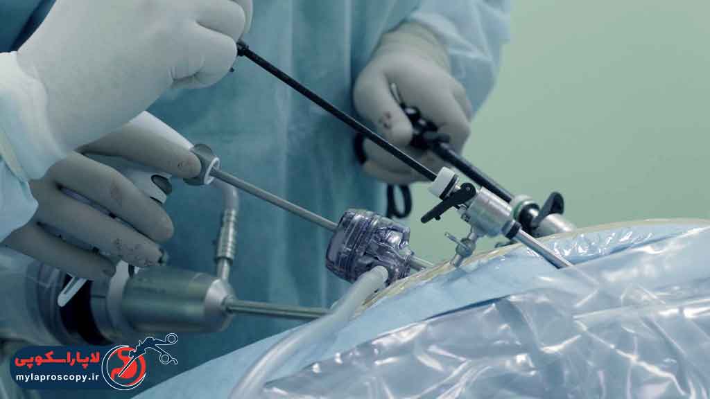 هزینه عمل لاپاراسکوپی برداشتن طحال در شیراز چقدر است؟