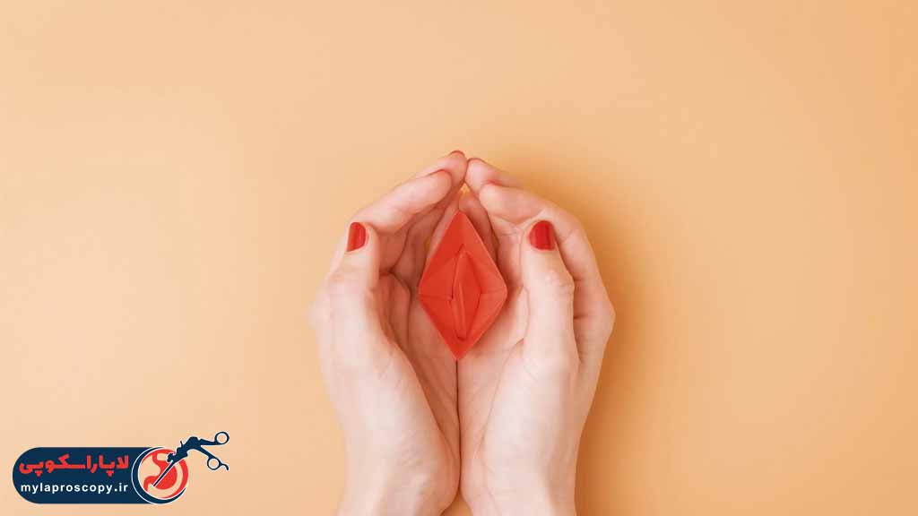 لابیاپلاستی چیست ؟