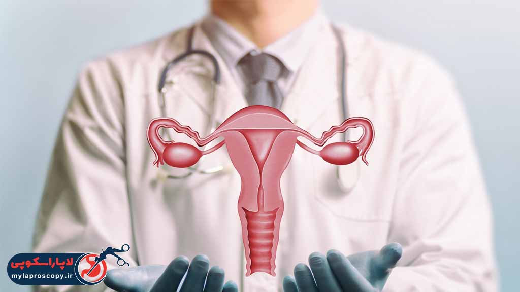 هیسترکتومی یا برداشتن رحم چیست؟