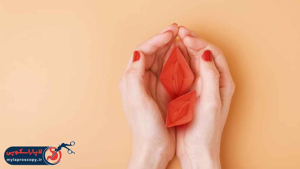 مراقبت‌ های پس از جراحی لابیا ماژورپلاستی