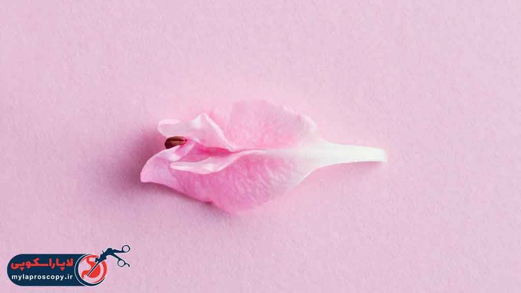 هزینه هودوپلاستی در شیراز چقدر است؟