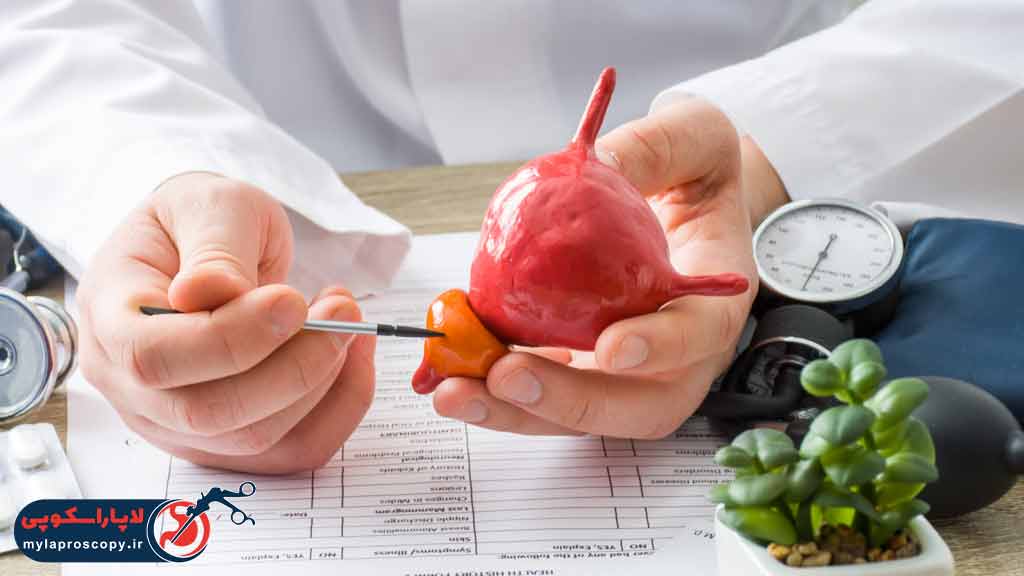 علائم بیماری سرطان پروستات در مردان چیست؟