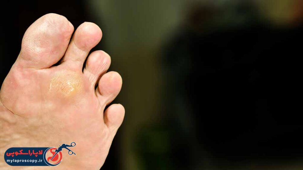 بهترین دکتر کرایوتراپی در شیراز