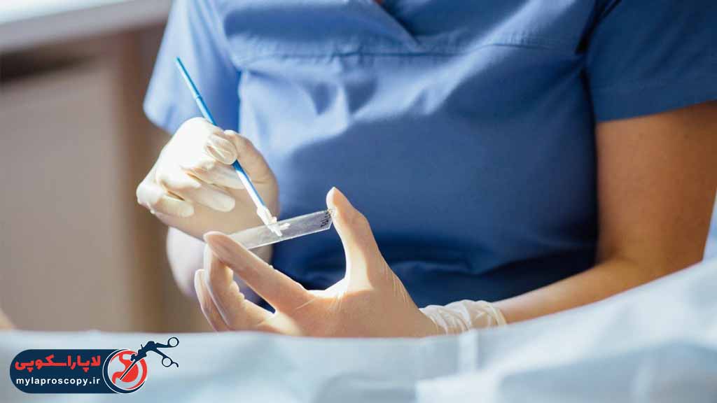 مزایای تست پاپ اسمیر چیست؟