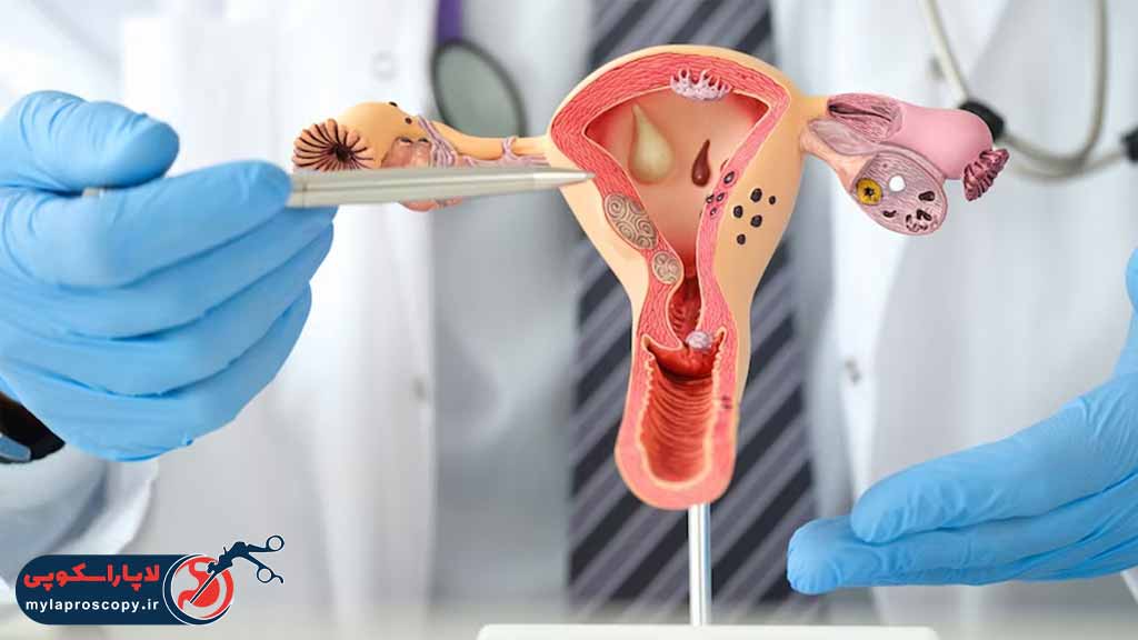 هزینه تست پاپ اسمیر شیراز در سال 1403 چقدر است؟