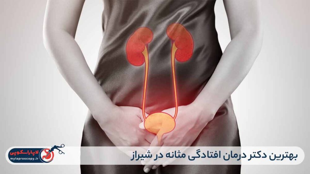 بهترین دکتر درمان افتادگی مثانه در شیراز