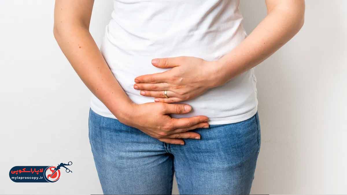 عوامل موثر بر  افتادگی مثانه