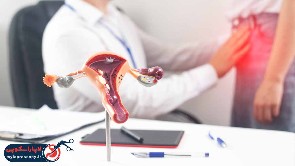 افتادگی رحم چیست؟
