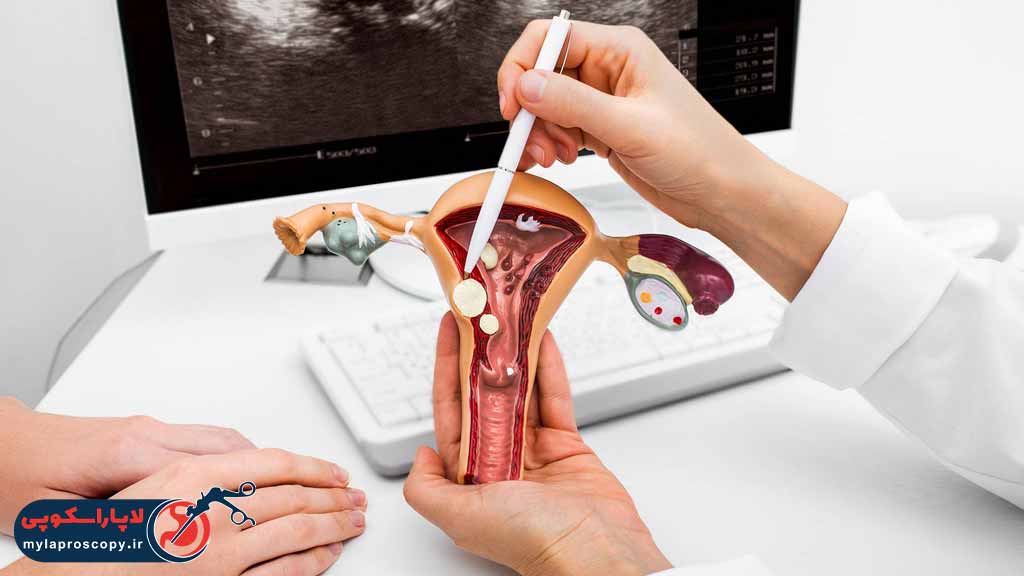 عوارض افتادگی رحم چیست؟
