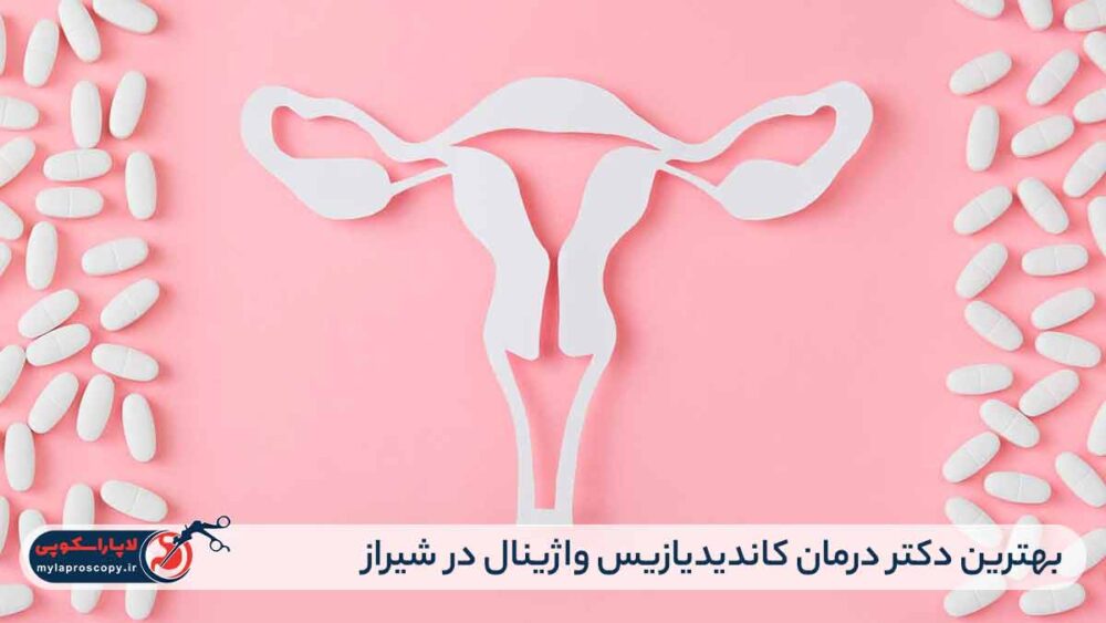 بهترین دکتر درمان کاندیدیازیس واژینال در شیراز