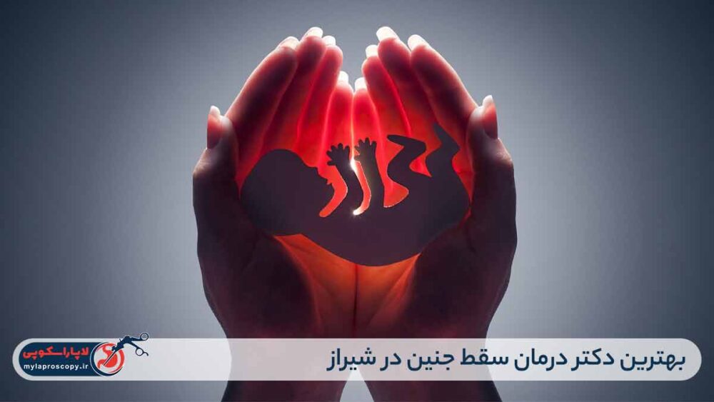 بهترین دکتر درمان سقط جنین در شیراز